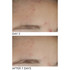 Dr Dennis Gross Alpha Beta On The Spot Gel 30ml