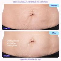 goPure Tighten & Smooth Belly Cream - Clinically Tested