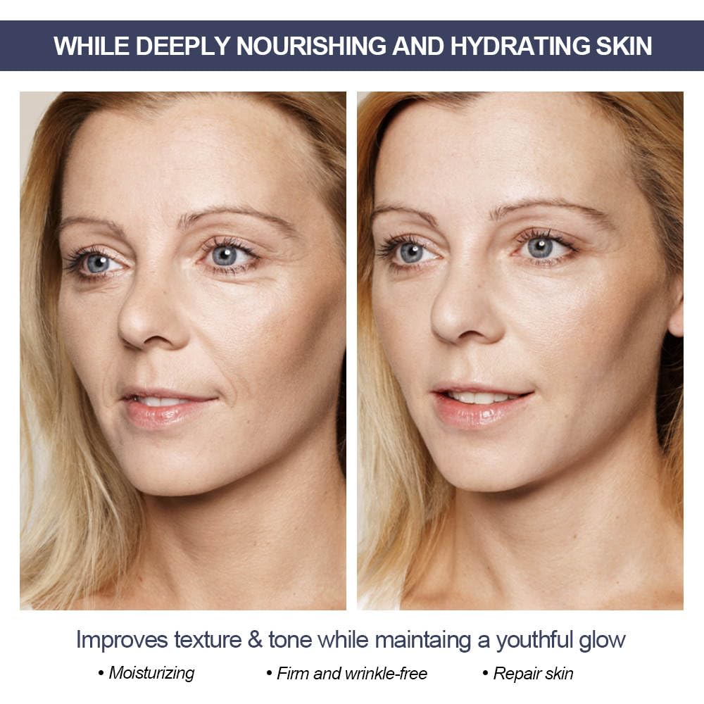 RADIANCE All Natural Retinol Intense Cream for Face Retinol Cream For Face Moisturizer Anti-Aging