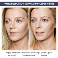 RADIANCE All Natural Retinol Intense Cream for Face Retinol Cream For Face Moisturizer Anti-Aging