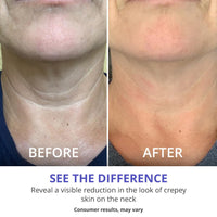 goPure Tighten and Lift Neck Cream - Clinically Tested - Pack of 2