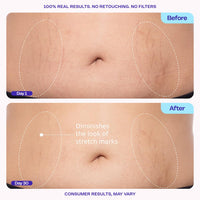 goPure Tighten & Smooth Belly Cream - Clinically Tested