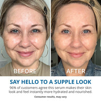 goPure Hyaluronic Acid Dramatically Dewy Serum - Hyaluronic Acid Serum for Face in a Nourishing Formula with Aloe Vera and Hibiscus Extract for Visibly Hydrated, Smoother-Looking Skin - 1 fl oz