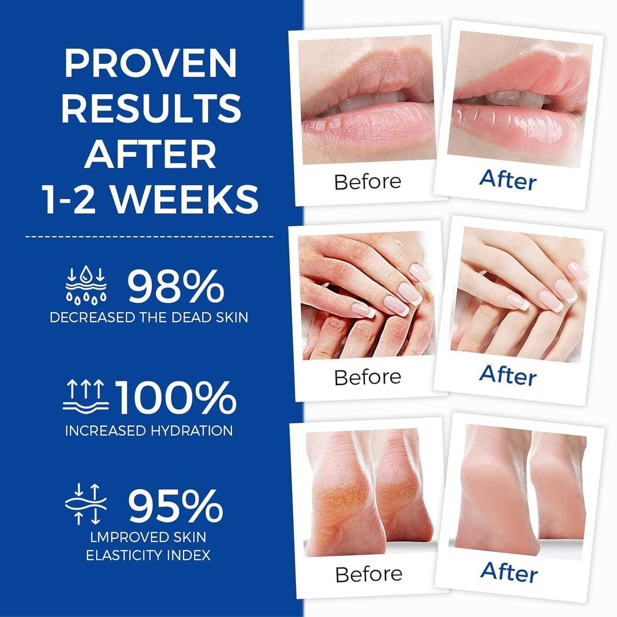 Healing Ointment, Advanced Therapy Skin Protectant,Soothes Cracked Hands and Chapped Lips