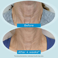 Plexaderm Dual Action Repair 1% Retinol Face Cream