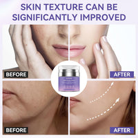 Face Moisturizer Retinol Cream, Neck Collagen Cream for Tightening Skin