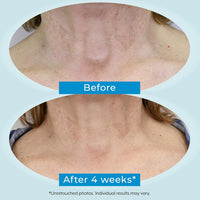 Plexaderm Dual Action Repair 1% Retinol Face Cream