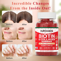 Hair Skin and Nails Gummies, 10000mcg Biotin Collagen Gummies for Women & Men, 90 Gummies