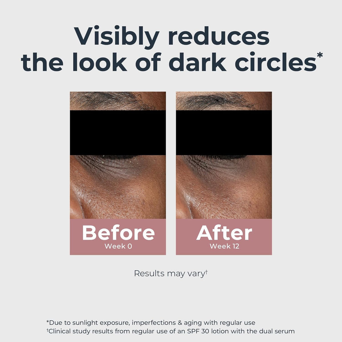 Eucerin Radiant Tone Eye Cream Dark Circle Corrector, Eye Brightening Cream with Thiamidol and Hyaluronic Acid, Helps Reduce the Look of Eye Puffiness, 0.5 Oz Tube