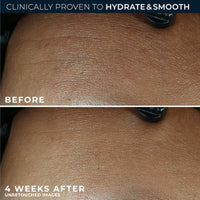 RoC Retinol Correxion Max Daily Hydration Anti-Aging Face Moisturizer with Hyaluronic Acid