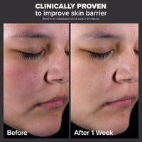 Paula's Choice Skin Perfecting 2% BHA Liquid Salicylic Acid Exfoliant, Gentle Facial Exfoliator for Blackheads, Large Pores, Wrinkles & Fine Lines, Travel Size, 30 mL Bottle