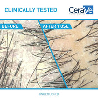 CeraVe 2 In 1 Hydrating Anti Dandruff Shampoo And Conditioner, 1% Pyrithione Zinc Dandruff Treatment