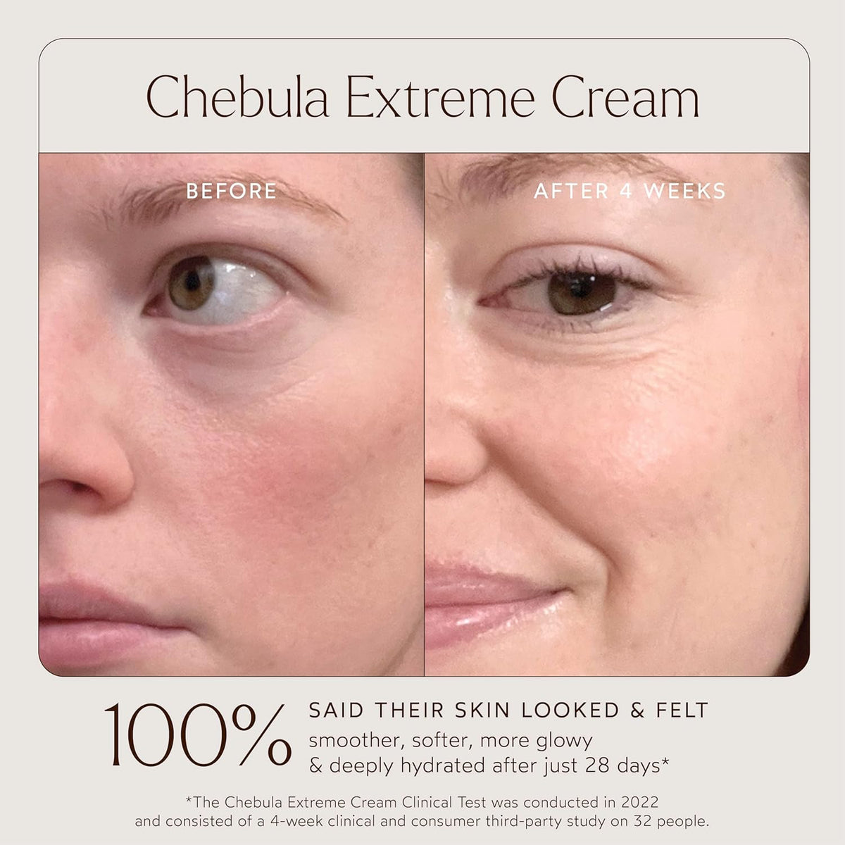 True Botanicals True Botanicals Chebula Extreme Cream | Anti-Aging Moisturizer w/Hyaluronic Acid | Treats Fine Lines & Wrinkles | Dry & Sensitive Skin | Dermatologist Tested, All Natural, Vegan | 1.7 oz | 50 ml