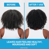 CeraVe 2 In 1 Hydrating Anti Dandruff Shampoo And Conditioner, 1% Pyrithione Zinc Dandruff Treatment
