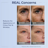 Plexaderm Rapid Reduction Eye Serum - Visibly Reduces Under-Eye Bags, Wrinkles, Dark Circles, Fine Lines & Crow's Feet Instantly, Anti Aging Wrinkle Remover for Face, 3 Full Size Tubes