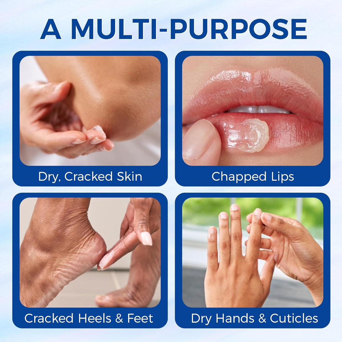 Healing Ointment, Advanced Therapy Skin Protectant,Soothes Cracked Hands and Chapped Lips