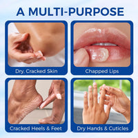 Healing Ointment, Advanced Therapy Skin Protectant,Soothes Cracked Hands and Chapped Lips