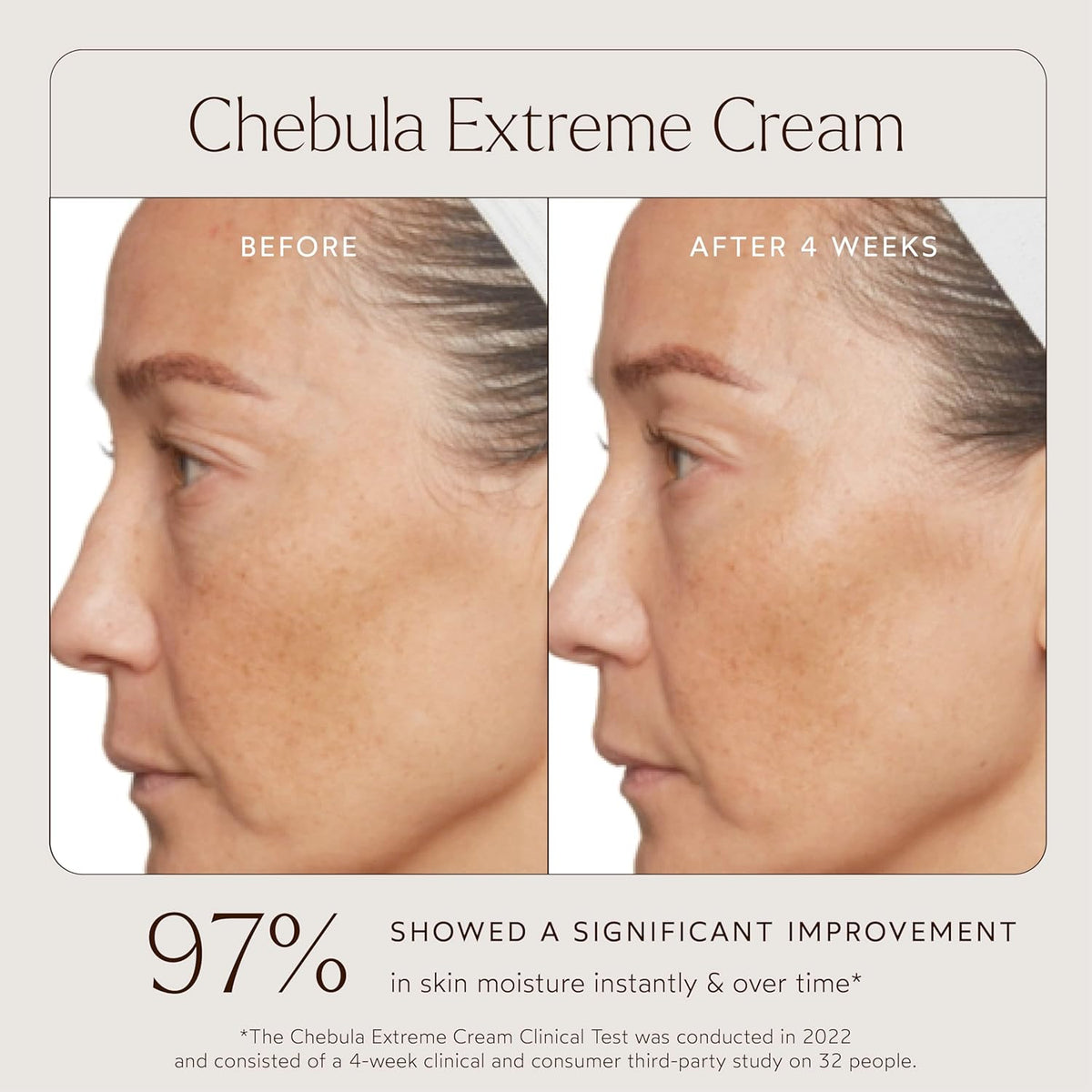 True Botanicals True Botanicals Chebula Extreme Cream | Anti-Aging Moisturizer w/Hyaluronic Acid | Treats Fine Lines & Wrinkles | Dry & Sensitive Skin | Dermatologist Tested, All Natural, Vegan | 1.7 oz | 50 ml