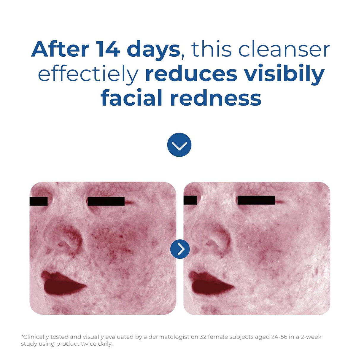 EltaMD Skin Recovery Amino Acid Foaming Facial Cleanser, Gentle Face Cleanser for Sensitive Skin