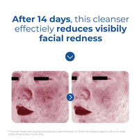 EltaMD Skin Recovery Amino Acid Foaming Facial Cleanser, Gentle Face Cleanser for Sensitive Skin