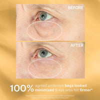 StriVectin Tighten & Lift Hyperlift Eye Cream Instant Eye Fix, Tightening Treatment for Bags, Lines and Crepiness, 0.34 Fl Oz,(Pack of 1)