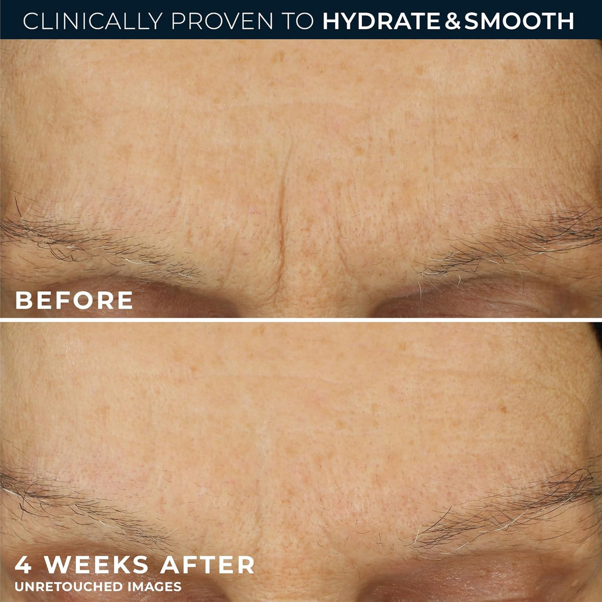 RoC Retinol Correxion Max Daily Hydration Anti-Aging Face Moisturizer with Hyaluronic Acid