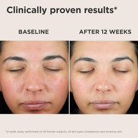 EltaMD UV Skin Recovery Face Sunscreen with Zinc Oxide, All Mineral, Safe for Sensitive Skin SPF 50