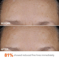 Dr Dennis Gross DermInfusions Blur + Repair Cream, Instantly Blurs Fine Lines, Smooths Skin with Satin-Matte Finish