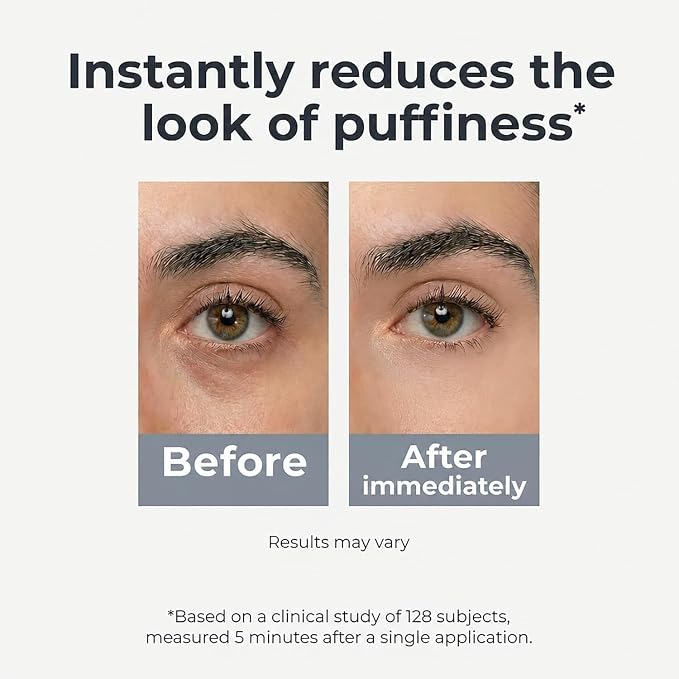 Under Eye Brightener Roller - Caffeine & Retinol Eye Serum for Dark Circles | Targets Puffiness & Fine Lines, Travel Essential Vegan Skincare, Cooling Eye Massage, Dermatologist-Tested, 0.52 fl oz