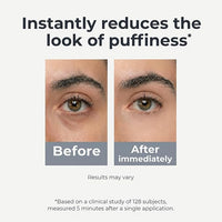 Under Eye Brightener Roller - Caffeine & Retinol Eye Serum for Dark Circles | Targets Puffiness & Fine Lines, Travel Essential Vegan Skincare, Cooling Eye Massage, Dermatologist-Tested, 0.52 fl oz