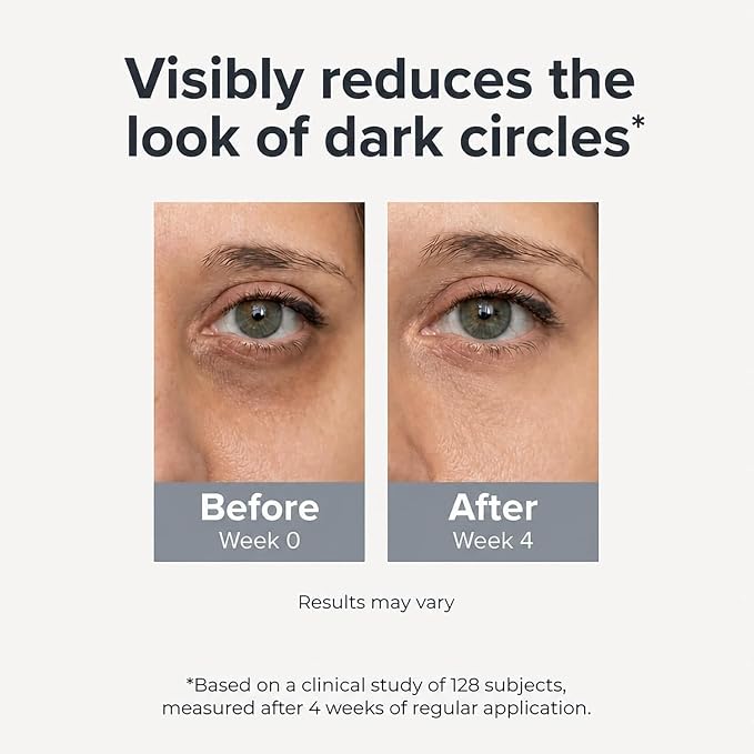 Under Eye Brightener Roller - Caffeine & Retinol Eye Serum for Dark Circles | Targets Puffiness & Fine Lines, Travel Essential Vegan Skincare, Cooling Eye Massage, Dermatologist-Tested, 0.52 fl oz