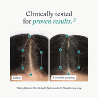 Nutrafol Women's Hair Growth Supplements and Hair Serum, Ages 18-44, Clinically Tested for Visible Thickness and Strength - 1 Month Supply, 1.7 Fl Oz Bottle