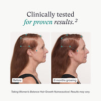 Nutrafol Women's Balance Hair Growth Supplement and Hair Serum, Ages 45,1.7 Fl Oz Bottle