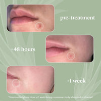 Honest Beauty Acne Fighting Spot Treatment for Oily Skin | 0.5 fl oz