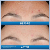 CeraVe Resurfacing Retinol Serum, Daily Brightening Face Serum with Licorice Root Extract & Niacinamide
