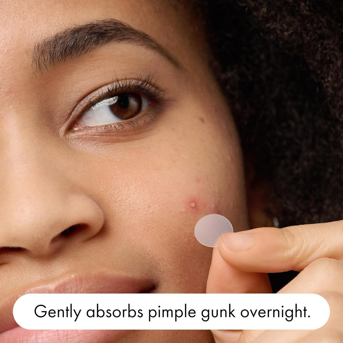 Hero Mighty Patch™ Original - Overnight Pimple Patch, Medical-Grade Hydrocolloid, Shields Skin and Gently Absorbs Pimple Gunk While You Sleep, Sensitive Skin Safe (60 Count)