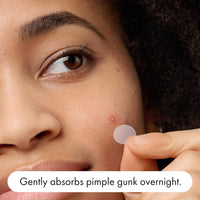 Hero Mighty Patch™ Original - Overnight Pimple Patch, Medical-Grade Hydrocolloid, Shields Skin and Gently Absorbs Pimple Gunk While You Sleep, Sensitive Skin Safe (60 Count)