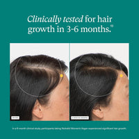 Nutrafol Women's Hair Growth Supplements, for Women 18-44 Years Old