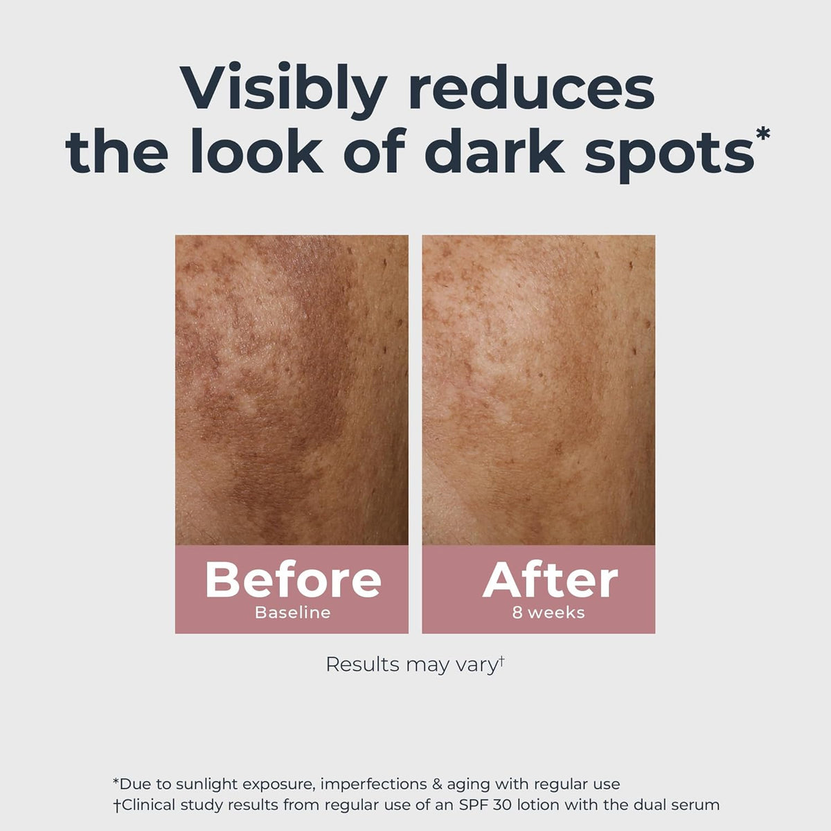 Eucerin Radiant Tone Dual Serum Dark Spot Corrector