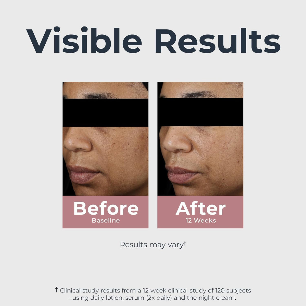 Eucerin Radiant Tone Dual Serum Dark Spot Corrector