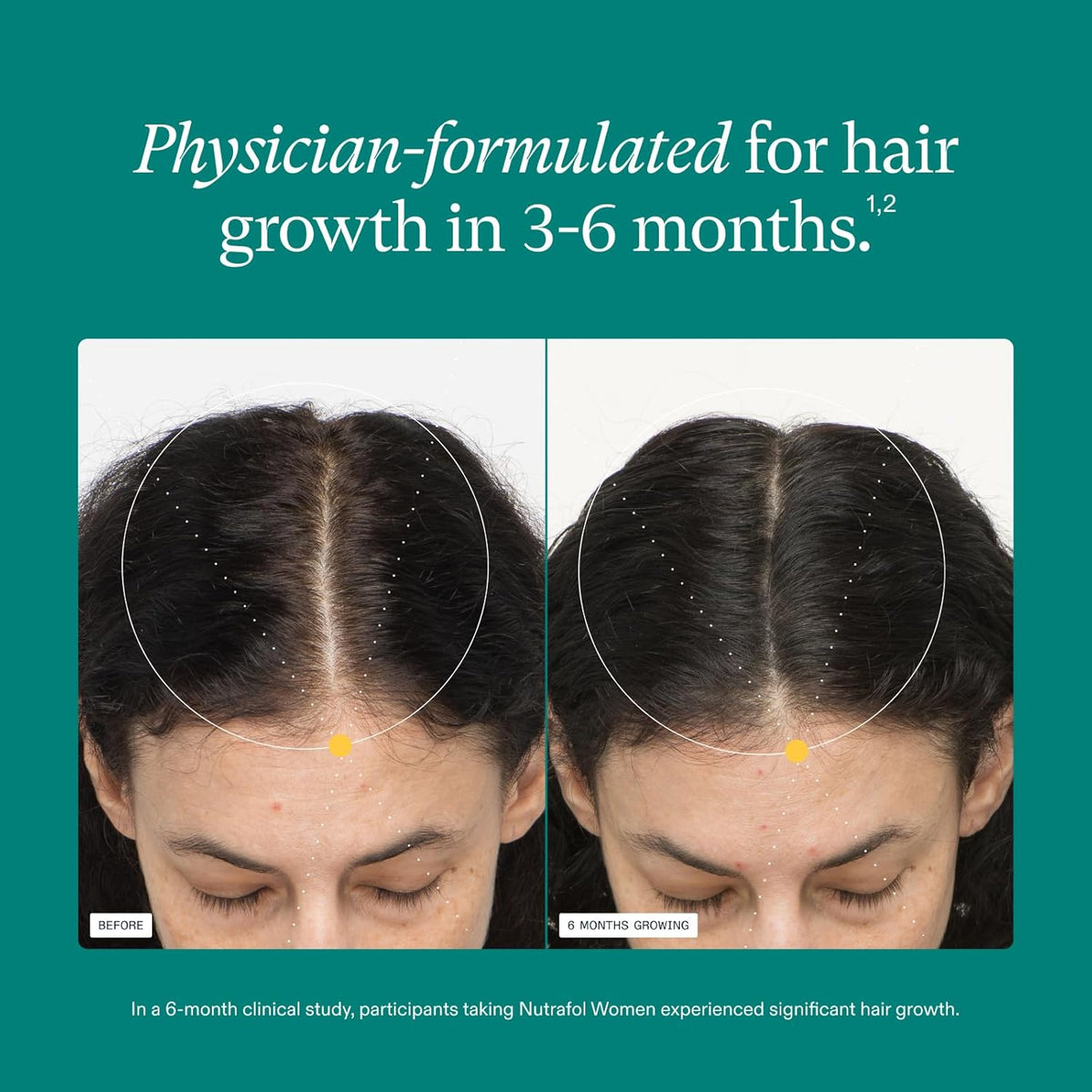 Nutrafol Women's Hair Growth Supplements, Ages 18-44