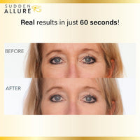 Sudden Allure Instant Face Lift Serum – Erase Under Eye Bags & Wrinkles in 60 Seconds - Firming Face & Eye Serum Lotion Cream - Instantly Tighten & Reduce Eye Bags & Crows Feet | Made in USA (10 ml)