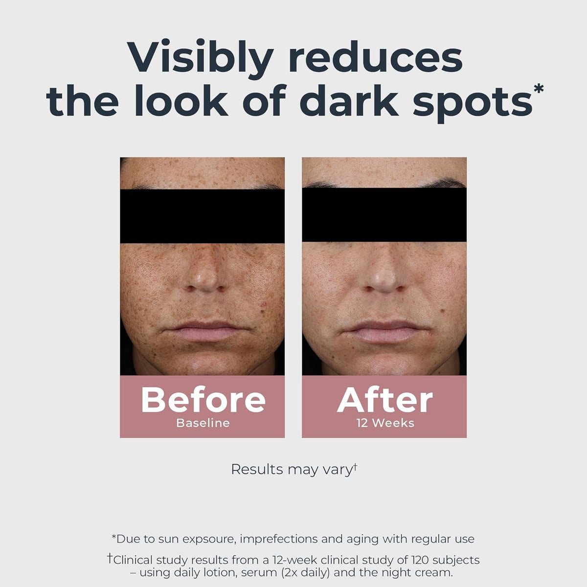 Eucerin Radiant Tone Dual Serum Dark Spot Corrector