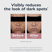 Eucerin Radiant Tone Dual Serum Dark Spot Corrector
