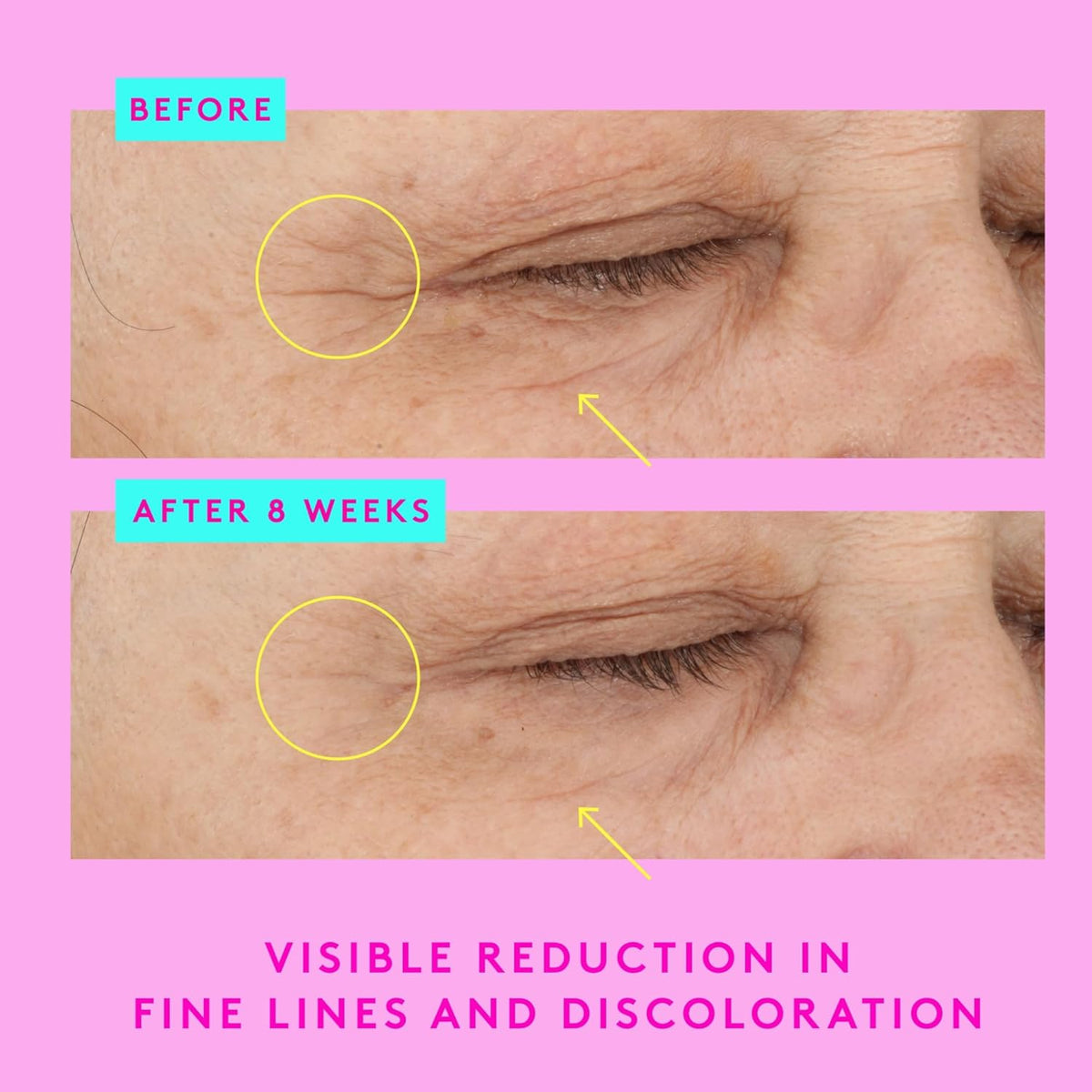 Drunk Elephant A-Shaba Complex Eye Serum - 15 ml/.5 fl oz - .1% Retinol Eye Cream - Clean Clinical Skincare - Cruelty-Free - Dermatologist-Tested - Free of Essential Oils, Silicones, and Fragrance