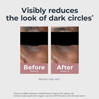 Eucerin Radiant Tone Eye Cream Dark Circle Corrector, Eye Brightening Cream with Thiamidol and Hyaluronic Acid, Helps Reduce the Look of Eye Puffiness, 0.5 Oz Tube