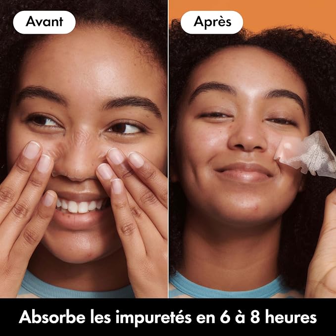 Hero Cosmetics Mighty Patch Nose, XL Hydrocolloid Spot Patches for Overnight Use, Absorb Gunk in 6 to 8 Hours, 10 Patches