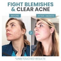 Eva Naturals Vitamin C Face Serum With Hyaluronic Acid - Anti Aging Serum - Reduce Dark Spots, Acne & Wrinkles - Retinol, Niacinamide & Salicylic Acid, Brightening Skin Serum for Glowing Skin