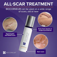 Advanced Scar Treatment with Silishield® & SPF 30 10g – Made in the USA