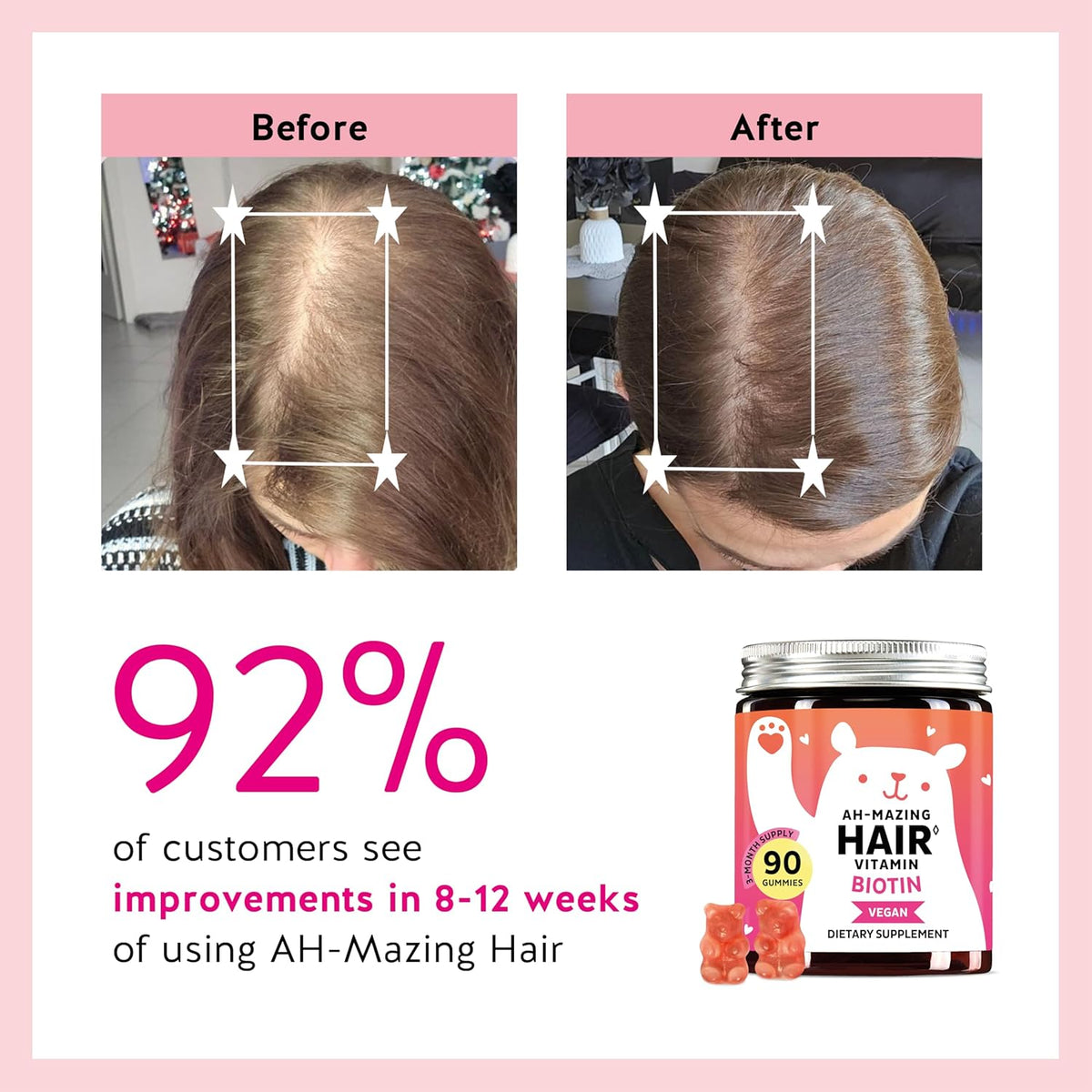 Biotin Gummies for Hair, Skin & Nails. 5,000 mcg 90 Gummies-usa made